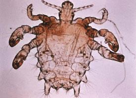 Photo: Crab louse