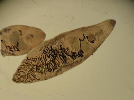 Photo: Lancet liver fluke