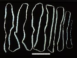 Photo: Beef tapeworm