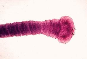 Photo: Pork tapeworm